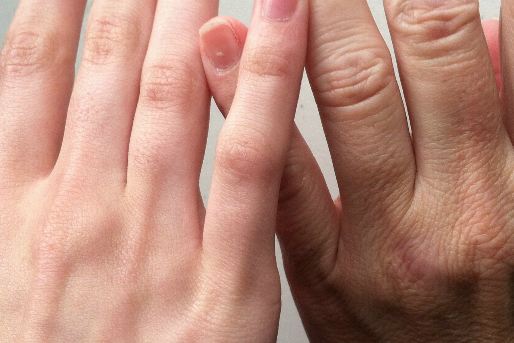 Think Wrinkles Are Ugly? What Our Aging Hands Reveal 