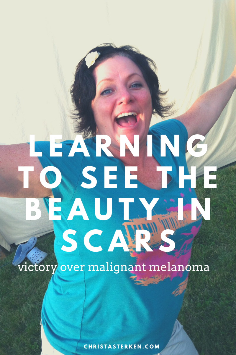 The beauty of a scar that removed melanoma